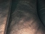 Scars-Dimples-3.jpg