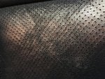 Scars-Dimples-2.jpg